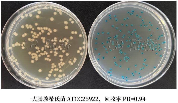 GB 4789.38-2025《食品安全國(guó)家標(biāo)準(zhǔn) 食品微生物學(xué)檢驗(yàn) 大腸埃希氏菌計(jì)數(shù)》解讀 GB 4789.38-2025《食品安全國(guó)家標(biāo)準(zhǔn) 食品微生物學(xué)檢驗(yàn) 大腸埃希氏菌計(jì)數(shù)》解讀